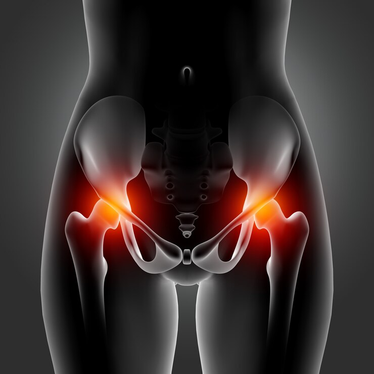 Yalancı Siyatik” (Priformis sendromu)