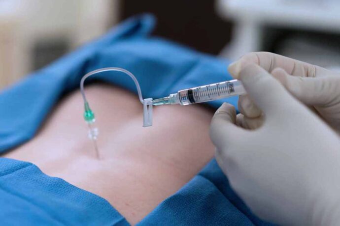 Epidural enjeksiyonlar